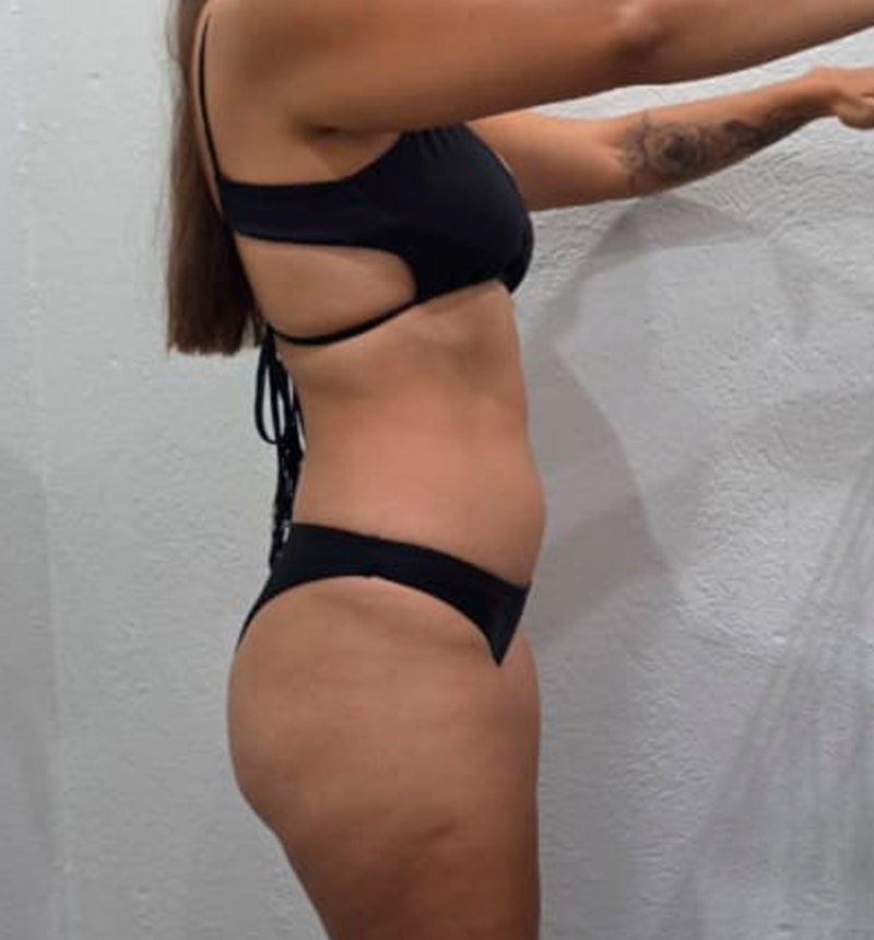 ANTES